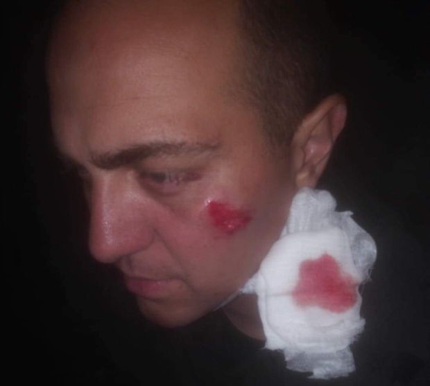 УЗНЕМИРУЈУЋЕ: Погледајте слике рањених полицајаца које су синоћ напали хулигани (ФОТО)